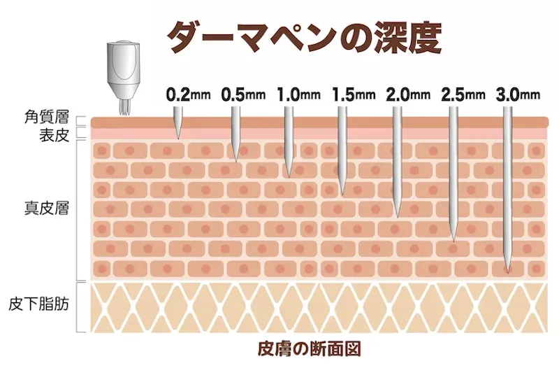 ダーマペン深度