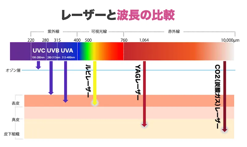 レーザー波長比較