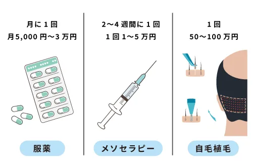 AGAの治療方法